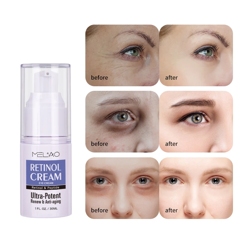 MELAO Tightening Anti-Aging Brighten Hydrate Soothe Dark Circles Puffiness Wrinkle Prevention Retinol Peptide Eye Cream