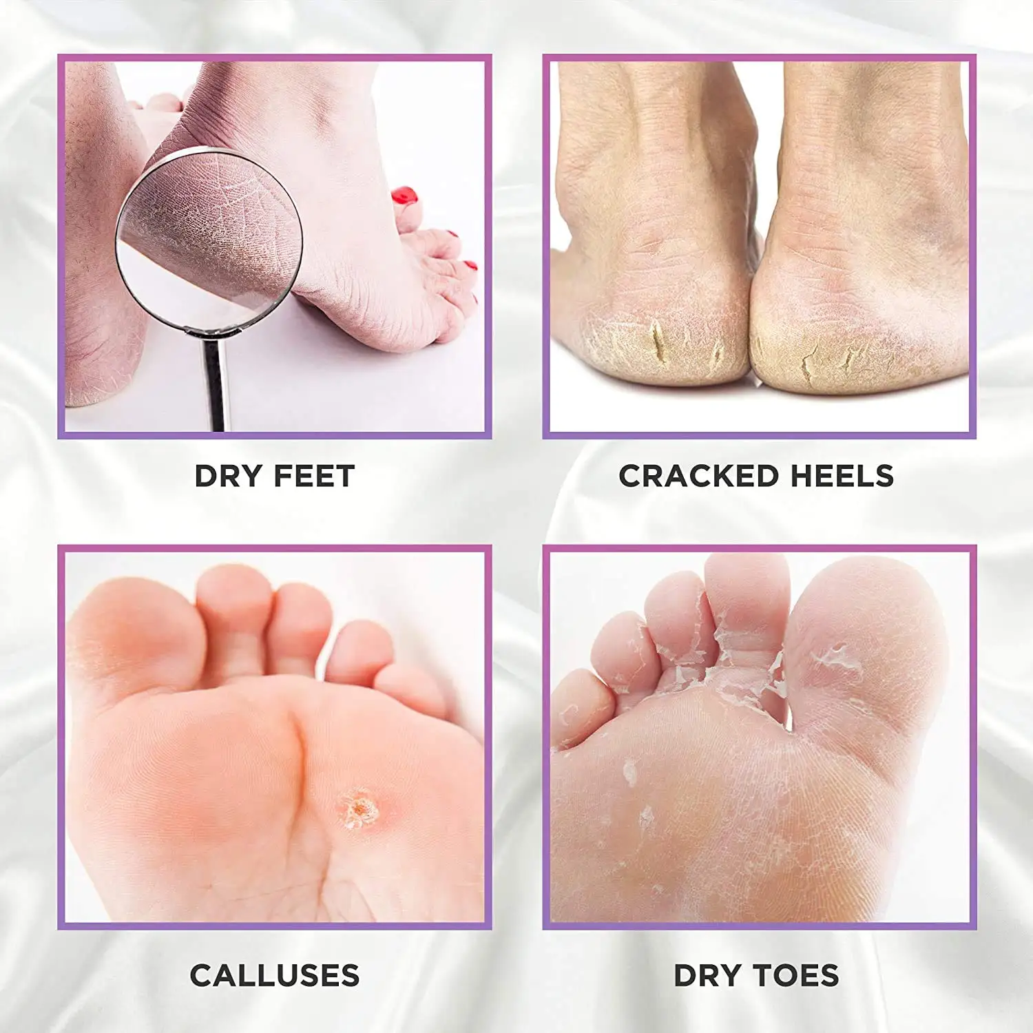 Foot Peel Mask 2 Pairs Natural Foot Peeling Mask Smoother Feet in a Week Remove Calluses & Dead Skin