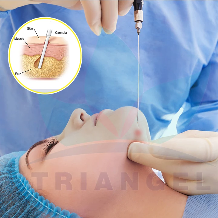 TRIANGELASER subdermico endolaser diodo 1470 fibra machine fiber optic lifting clinic use device