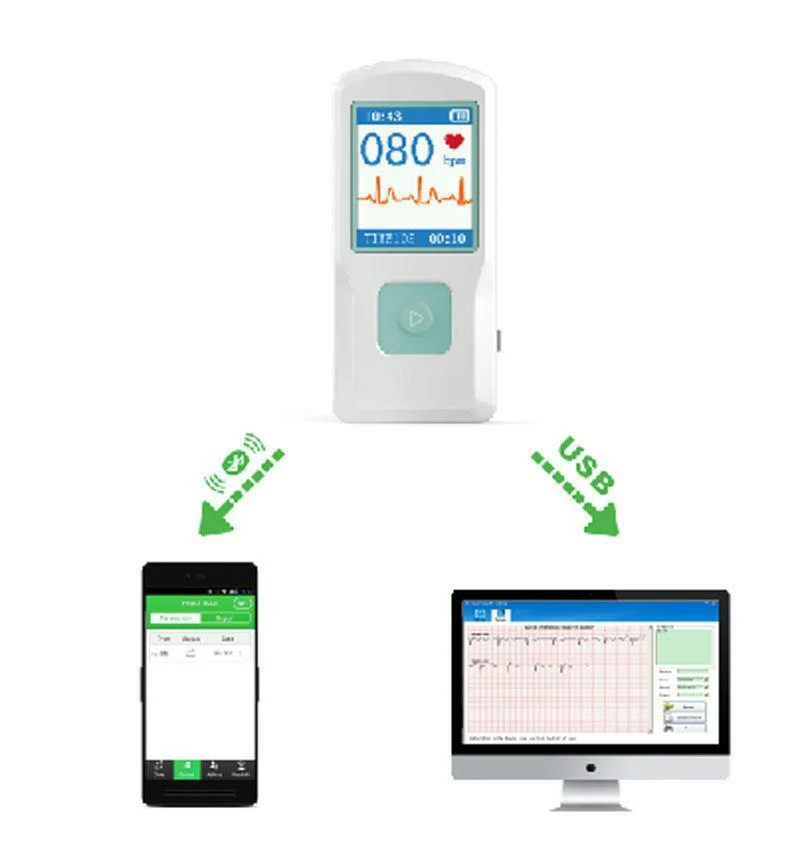 Portable Ecg Monitor Blue tooth Device Ai based Machine Holter Ecg