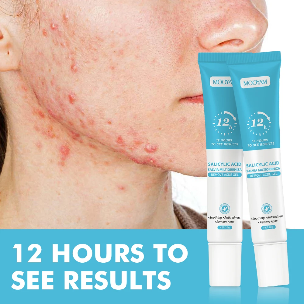 Fast Effective Repair Pimple Scar Anti Spots Removal Acne Gel Smooth Skin Shrink Pores Salicylic Acid Acne Treatment Cream