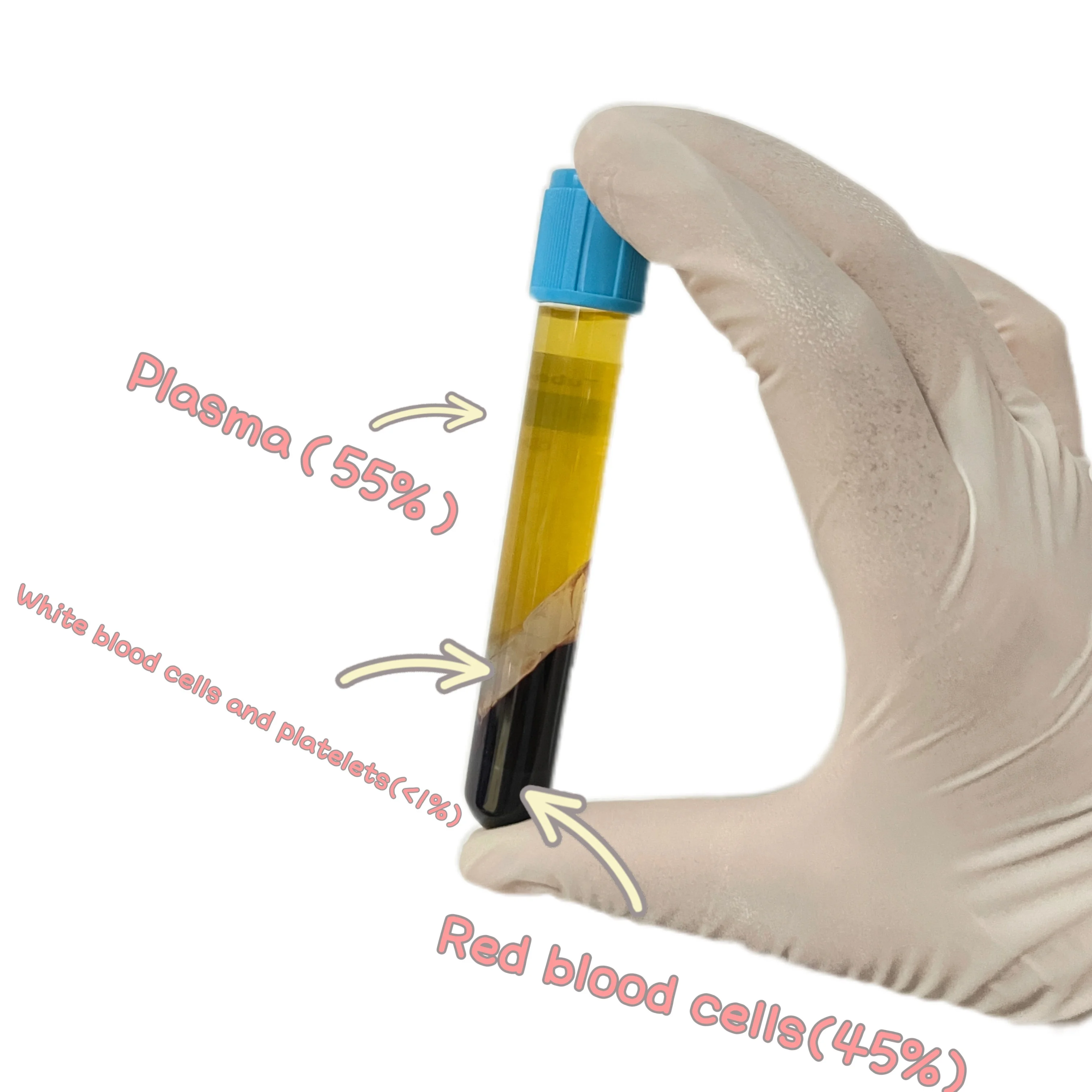 Medical Platelet Rich Plasma PRP Tube PRP with Acd Gel for Sale in Lab