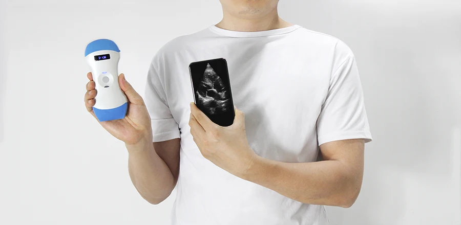  Новейший 3 в 1 Wi-Fi Беспроводной ультразвуковой зонд цветной допплер сканер для доктора использования