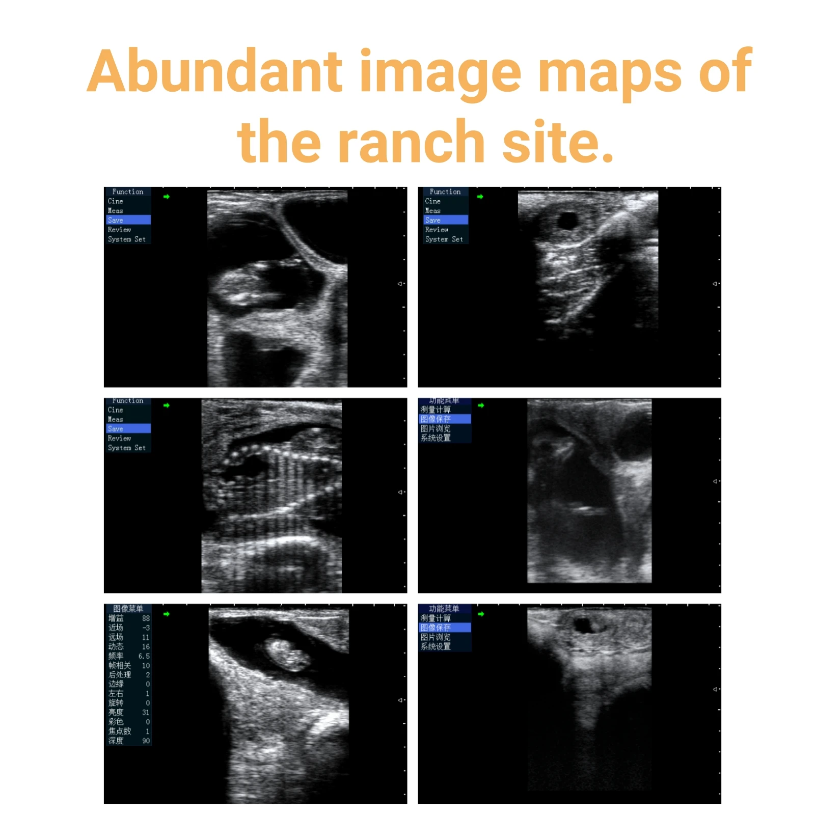 Ультразвуковой цифровой ультразвуковой сканер
