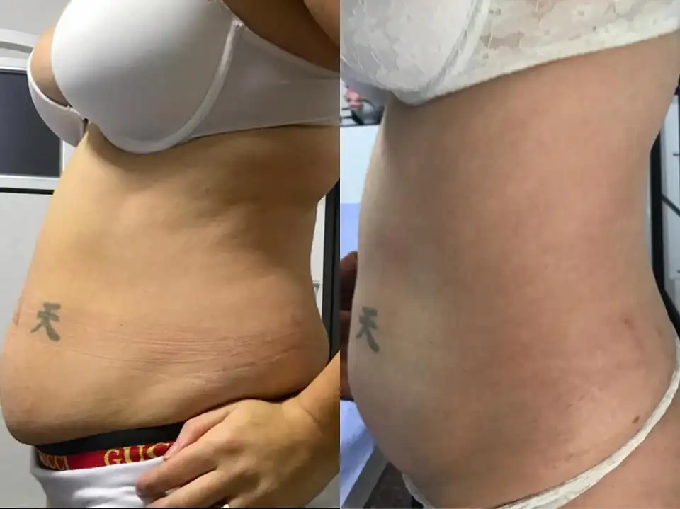 2022 laser beauty equipment ems training machine skin tightening muscle build machine for salon