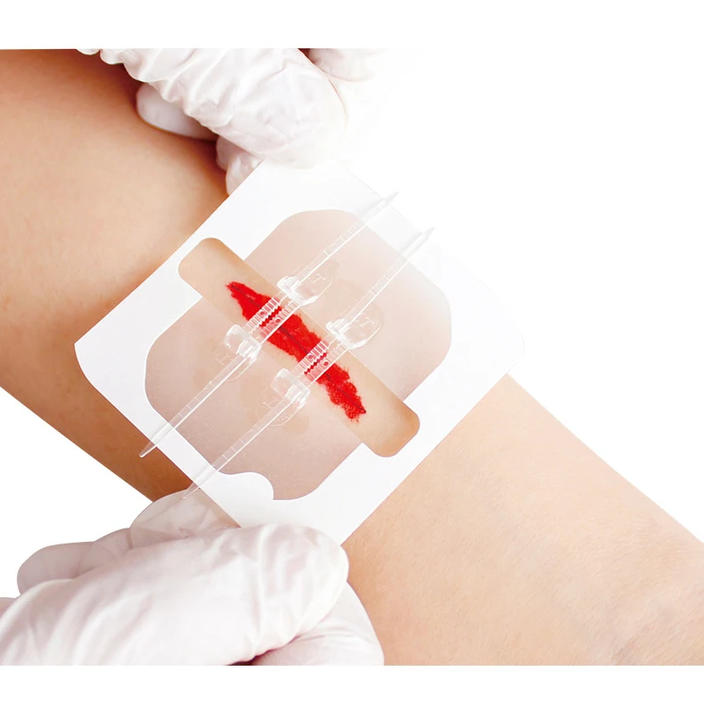 Застежка-молния устройство для застежки раны застежка-молния