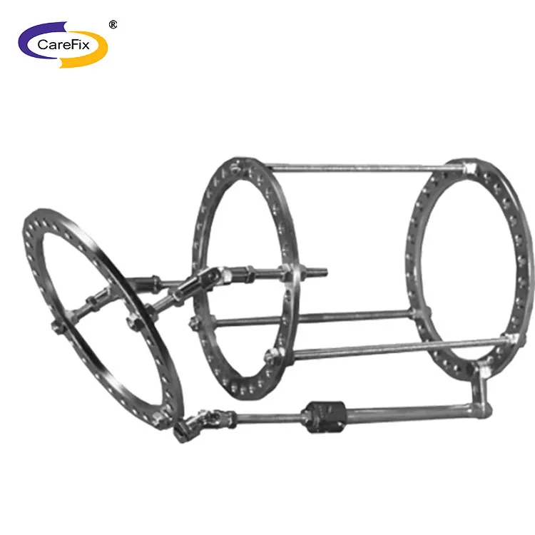 Конструкция бедренных суставов, фрагмент тазового сустава, феморальный внешний фиксатор ilizarov, внешний фиксатор