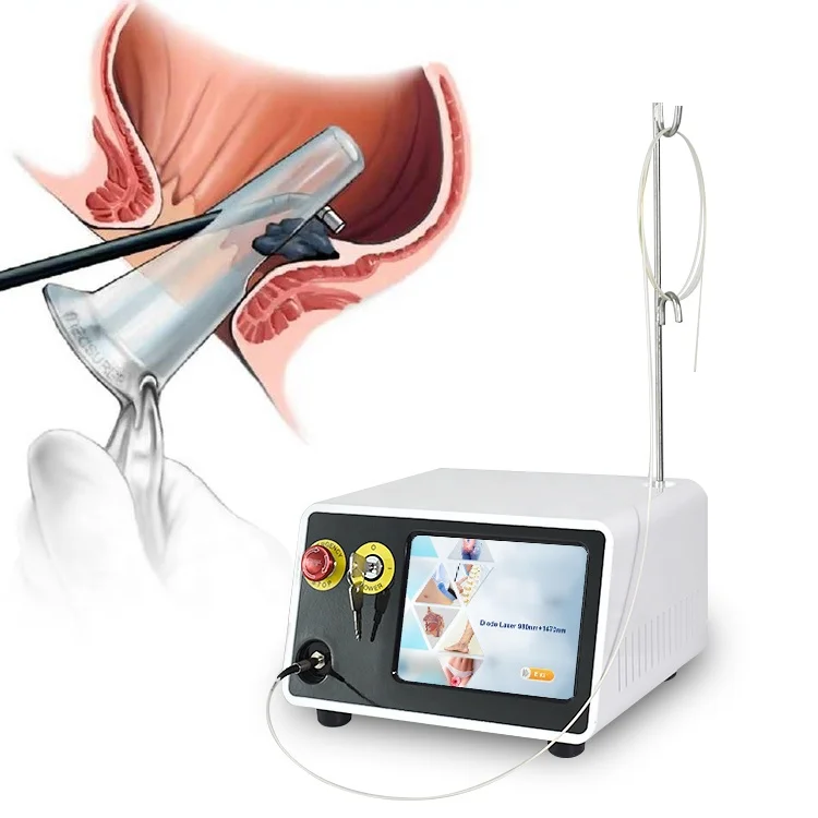 TOP SALE Multi-functions diode laser 1470nm 980nm Anal Fistula surgery laser treatment / Proctology 1470nm Hemorrhoids Laser