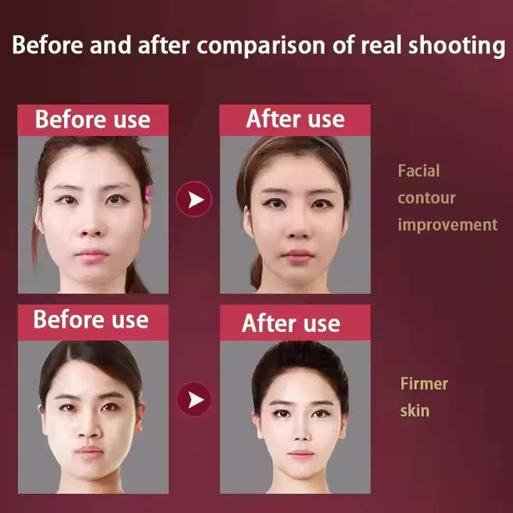 ABS Electric V-Face LED Beauty Device Double Chin Massager with EMS Vibration for Facial Firming & Face Lifting USB Plug Type
