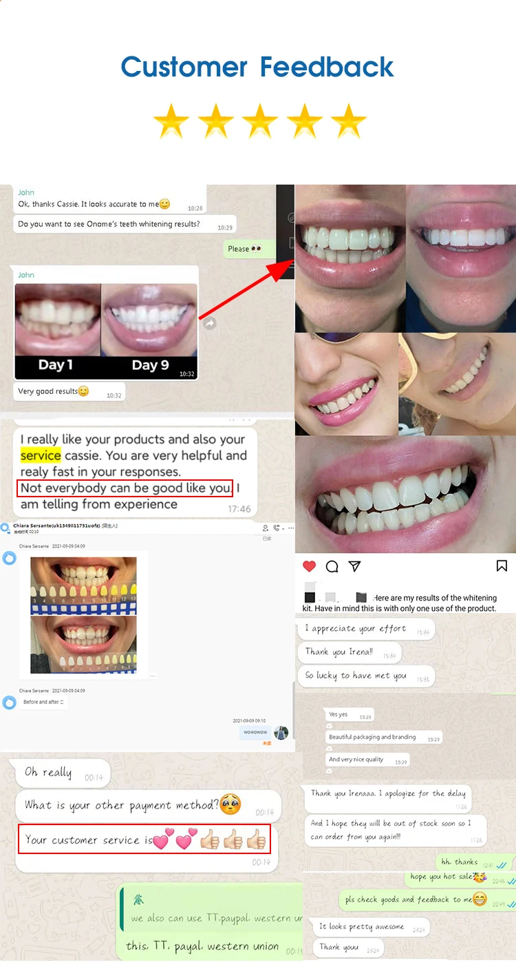 teeth whitening kit (12).jpg