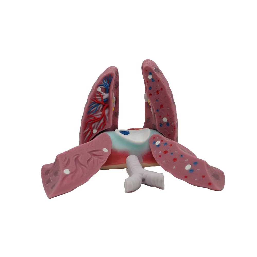 Factory Price Soft Silicone Left and Right Lung Anatomical Model for Medical Education