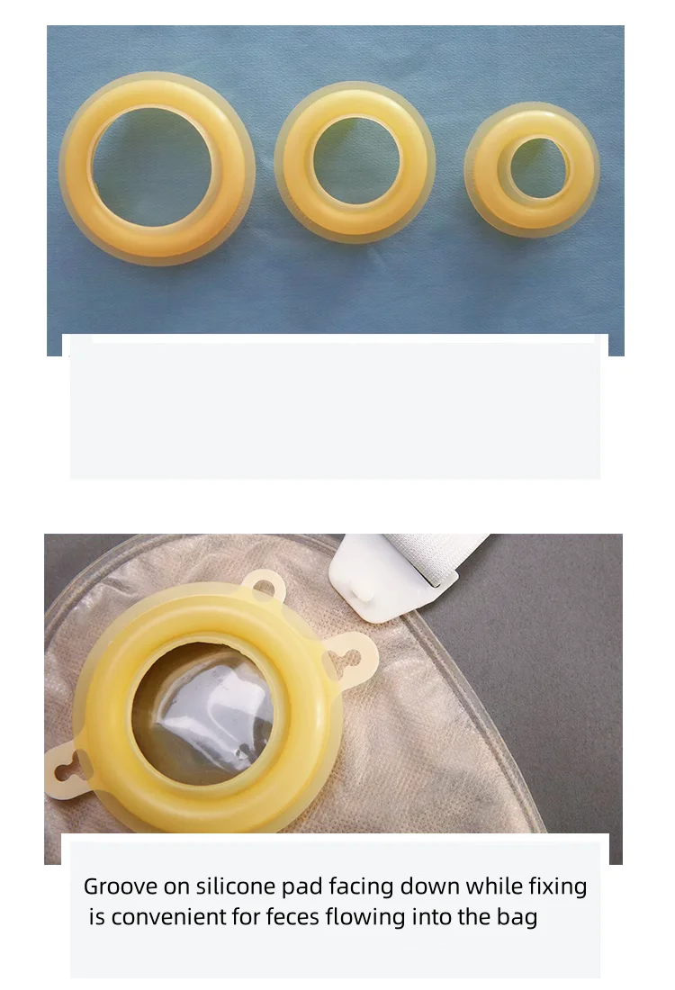 non-woven fabric two piece glue-free ostomy bag belt clip sealing colostomy bag set colostomy bag