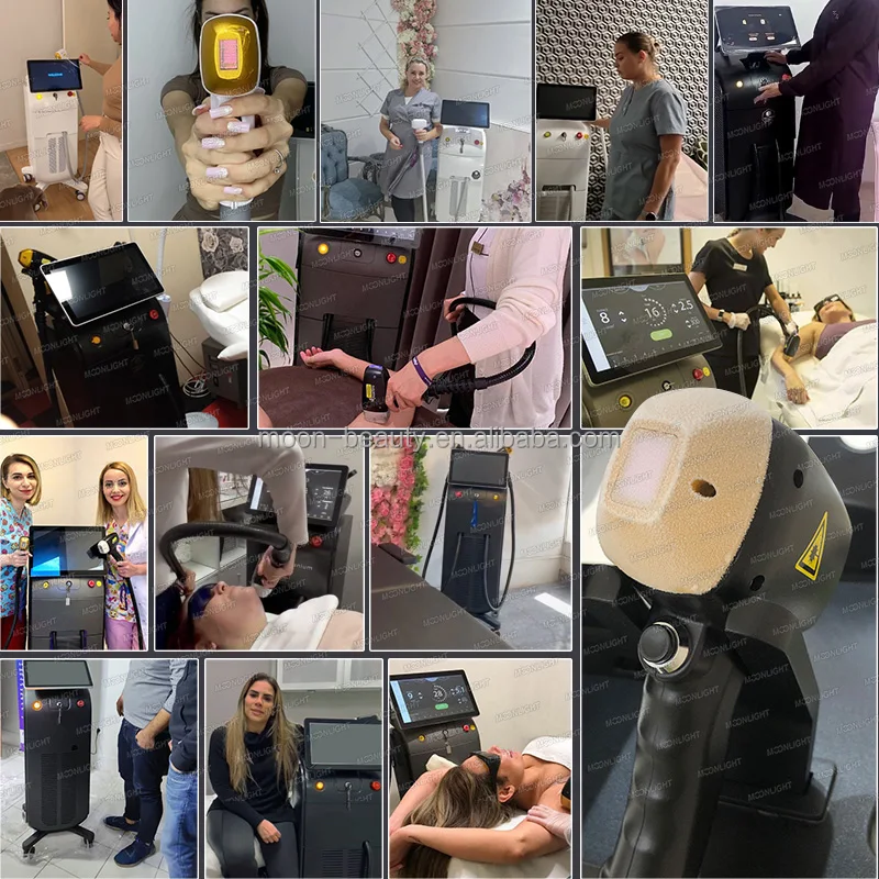 3 waves 808 755 1064 medical israel laser titanium 4 wavelength diode laser 940nm for permanent hair removal