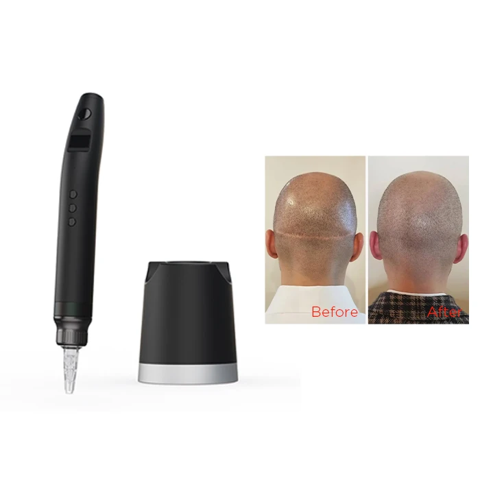 Nuojo factory SMP Product Factory customizing  black ink  micropigmentation tattoo machine Wireless  Machine