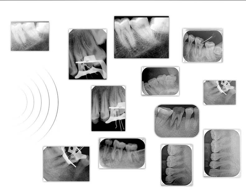 HD цифровой портативный рентгеновский Датчик водонепроницаемый датчик CarryX бренд завод