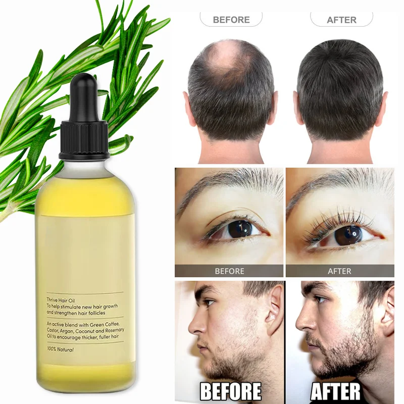 Professional Organic Fast Hair Regrowth Oil Best Anti Loss Rosemary Natural Hair Growth Serum Oil Private Label
