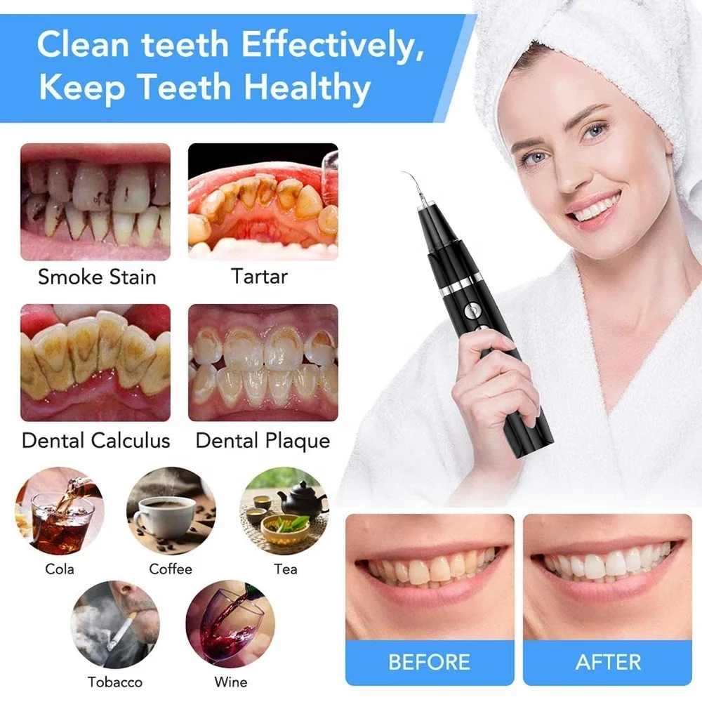 Electric Teeth Whitening Tool Ultrasonic Calculus Stain Remover Oral Tooth Plaque Tartar Cleaner Dental Scaler