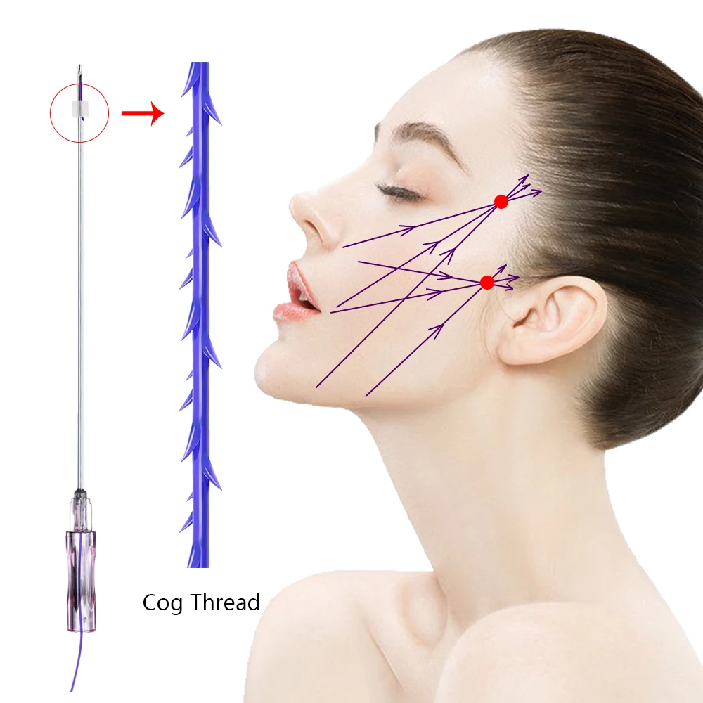 lifting pdo threads korean,hilos tensores pdo thread lift korea,fio de pdo cog 4d thread for lifting face and body