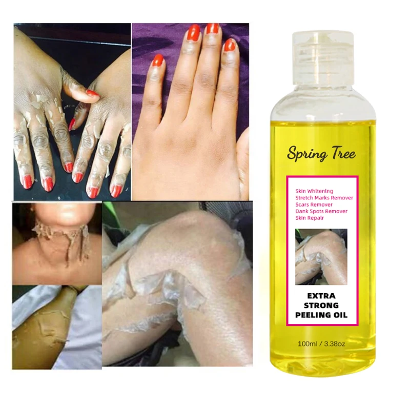 Super Strength Yellow Peeling Oil whitening Elbows Knees Hands Melanin Bleaching Dark Skin Strong Peeling Oil