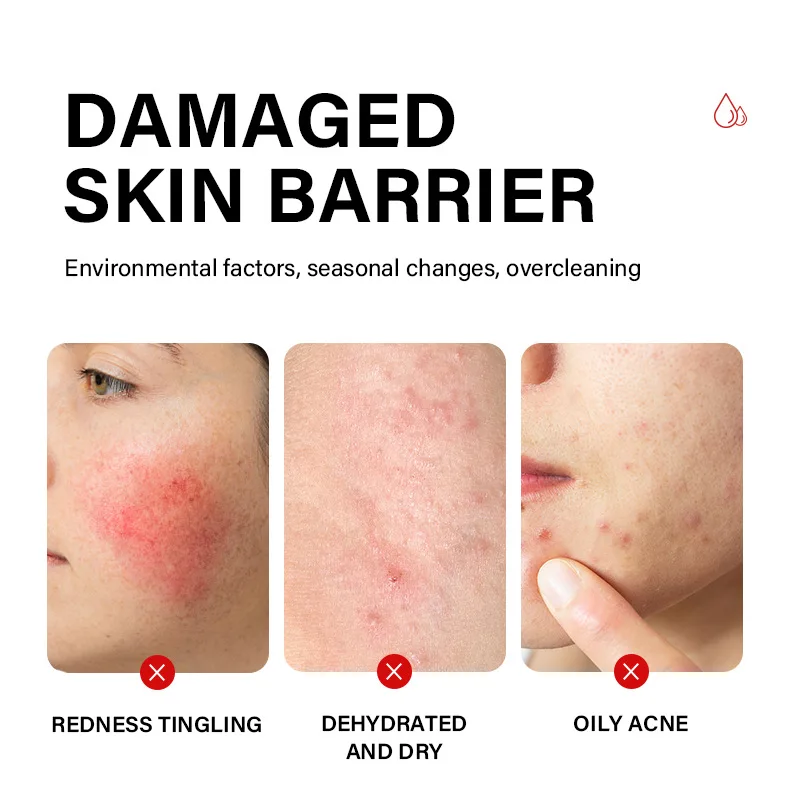 Mooyam 15 Minutes SOS Rescue Facial Spray Repair Facial Redness Essence Soothing Intensive Rescue Serum Facial Spray