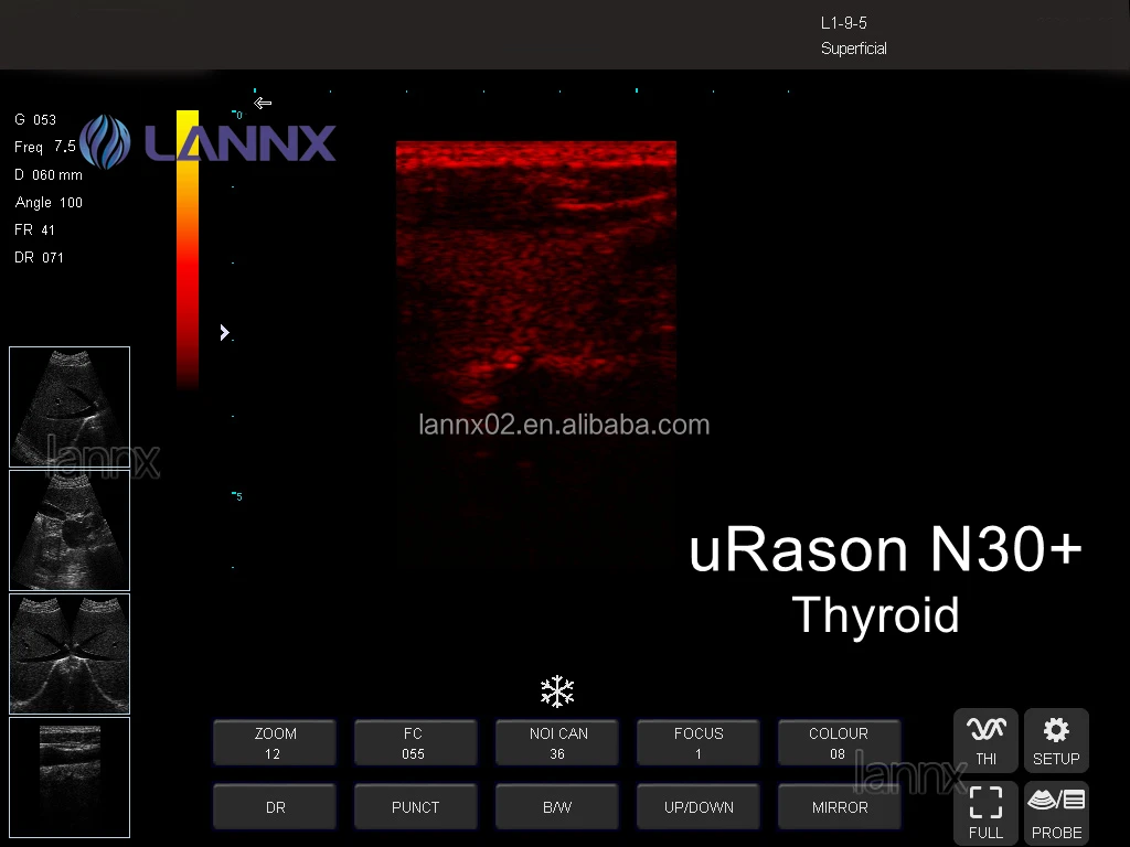 Многофункциональный портативный ноутбук LANNX uRason N30 + ультразвуковой аппарат