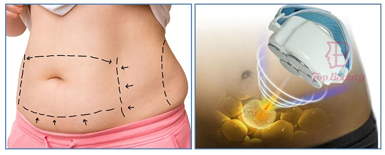 Body Rf Vacuum Cavit Slim Machine Cavitation Anti Cellulite Rf Vacuum Roller Massage Body Shape Vacuum Cavitation System