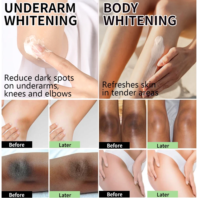 nicotinamide strong whitening body cream underarm lightening skin whitening cream and lotion