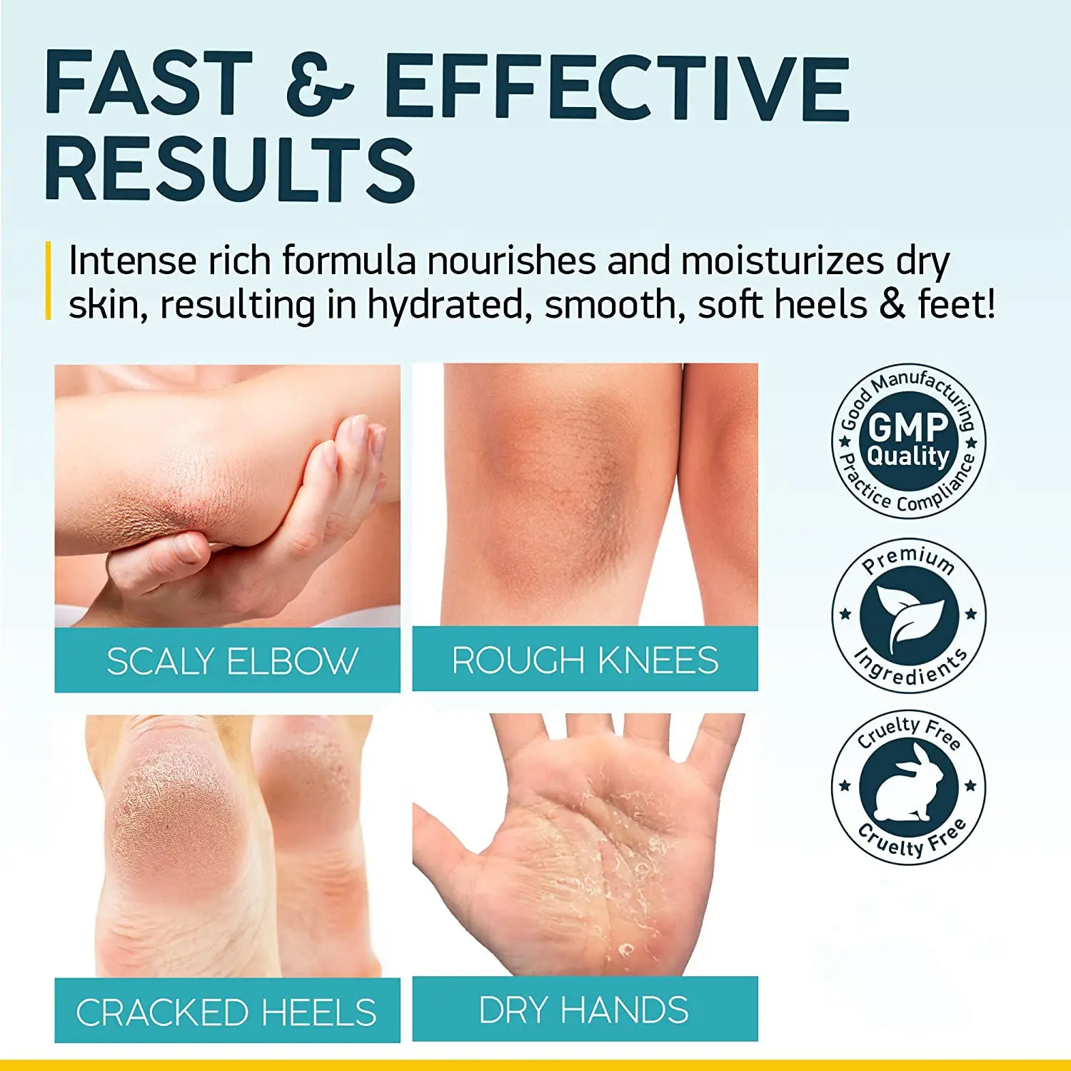 Hot Selling Foot And Body Care Moisturizing Exfoliating Nourishing 40% Urea Foot Cream Salicylic Acid Foot Cream