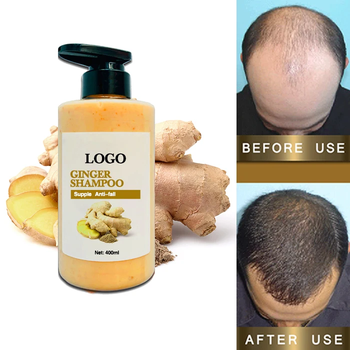 OEM Private Label Anti Itching  Anti Hair Loss  Natural Turmeric Shampoo Hair Care