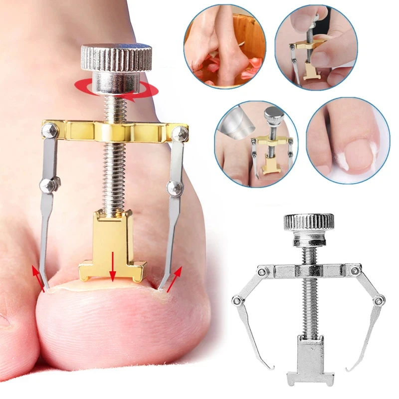 Ingrown Toenail Correction Brace Kit Professional Toe Nail Care Pedicure Manicure Clipper Fixer Recover Corrector Tool