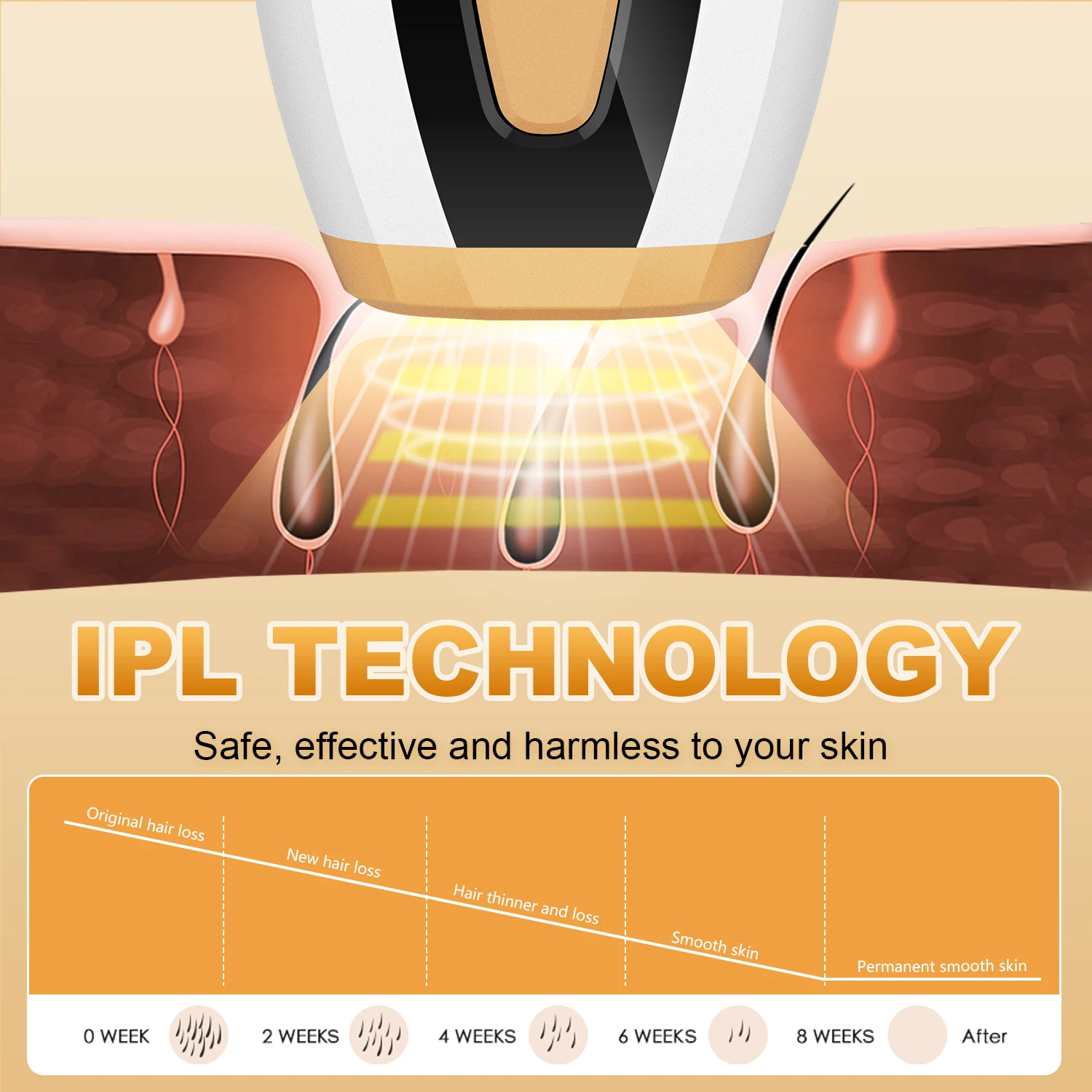 Factory OEM Laser Alexandrite Epilation Definitive Laser Professional Hair Removal Using IPL Laser