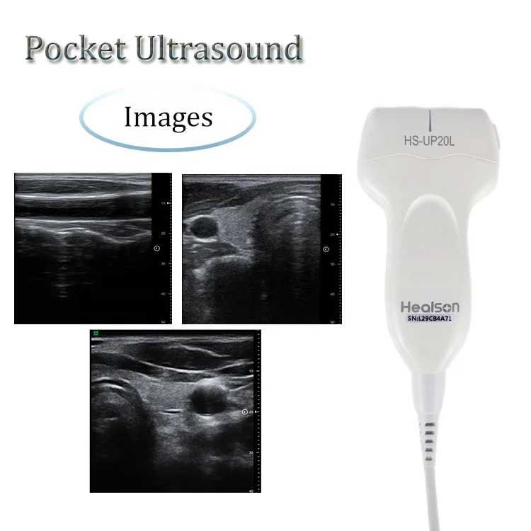 Healson Pocket Linear Doppler Handheld Digital Ultrasound Probe Portable USG Machine