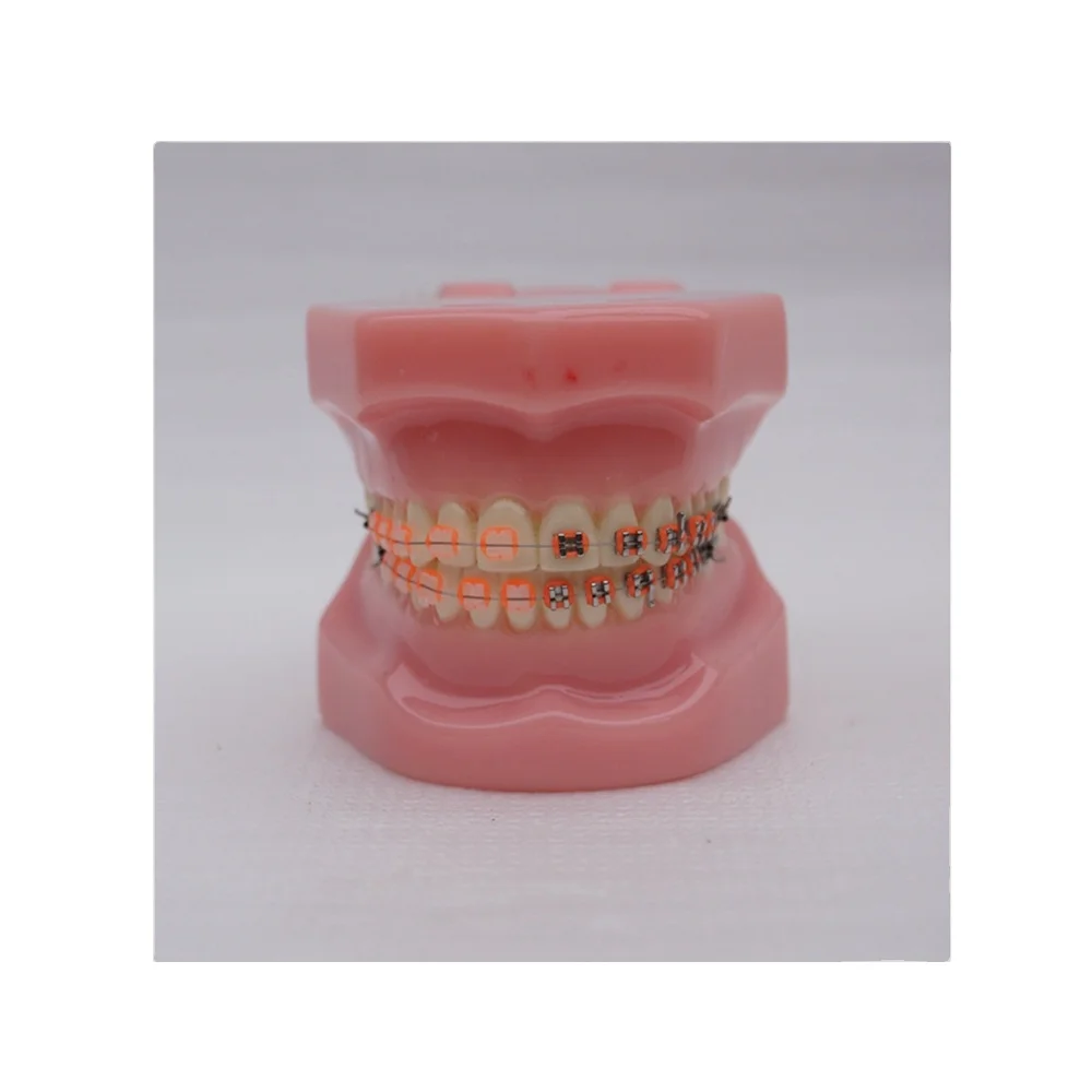 Dental Orthodontic Model 28 Teeth with Metal and Ceramic Bracket