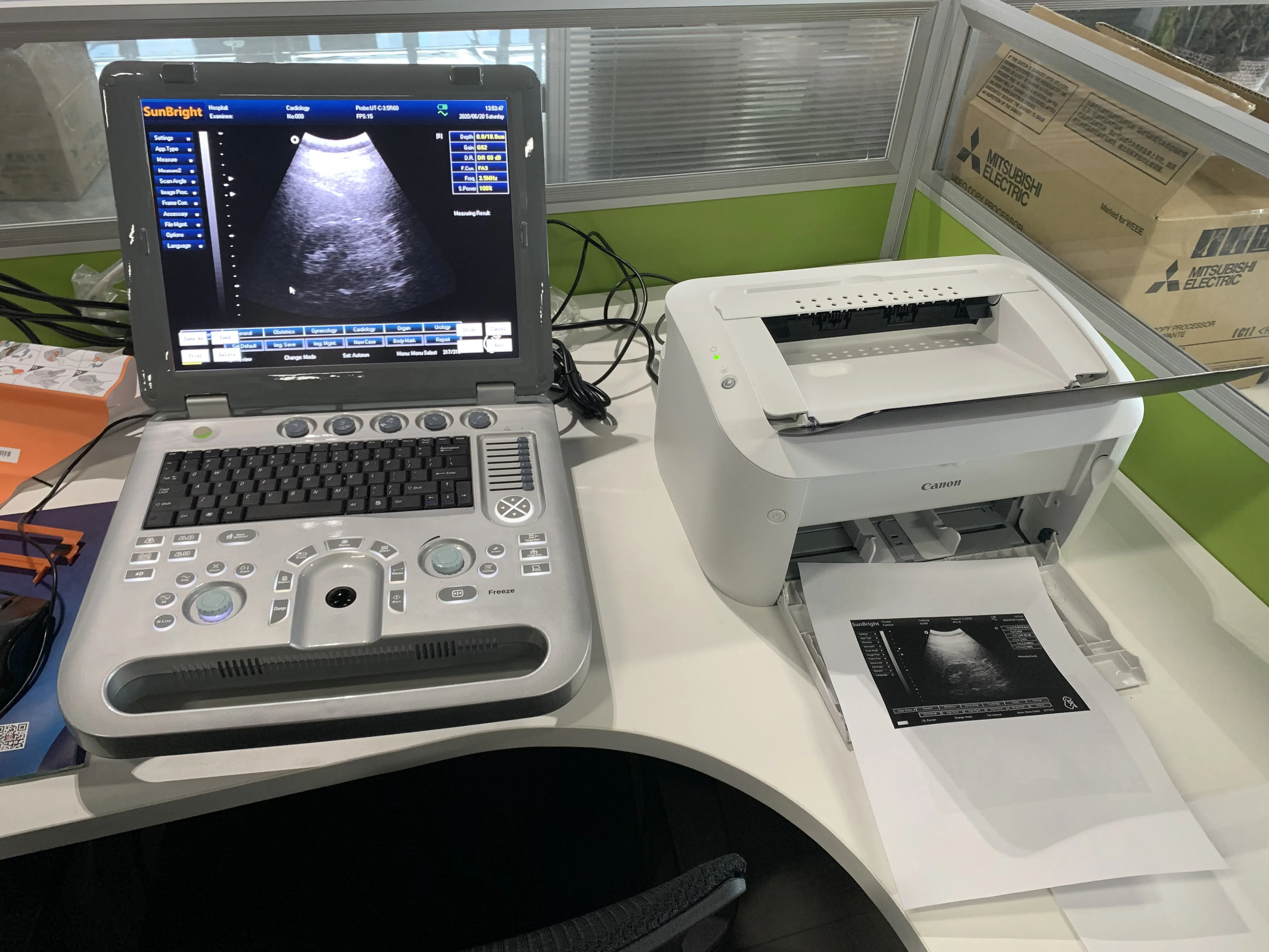 Конкурентоспособная цена 3D полностью цифровая ультразвуковая диагностическая система