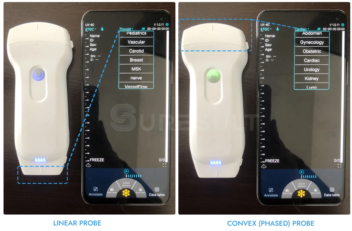 Suresult C10QT For Maternal And Child Health: Cardiac Ultrasound Probe Scanner From Beijing Konted