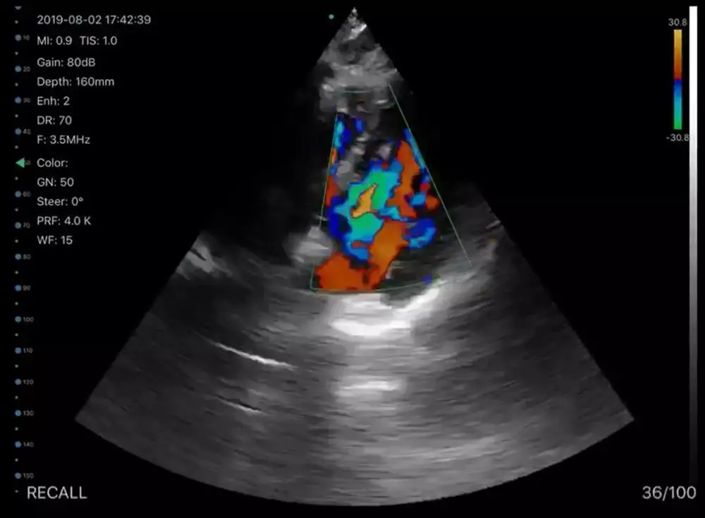 
Newest 3 in 1 New Types Wireless Convex / Linear / Cardiac Ultrasound Probe Portable Color Fetal Doppler 