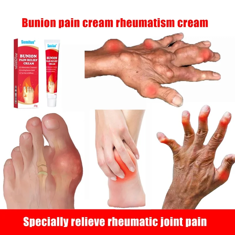 20g Joint Toe Pain Cream Bunion Gout Foot Cream Pain Relief Stiffness Inflammation Treatment Arching Treatment