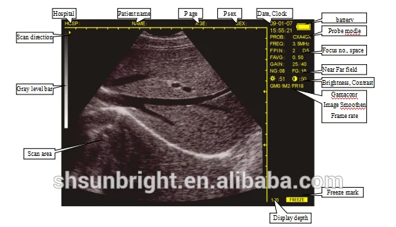 Sunbright handheld veterinary ultrasound device pregnancy ultrasound scanner for animal