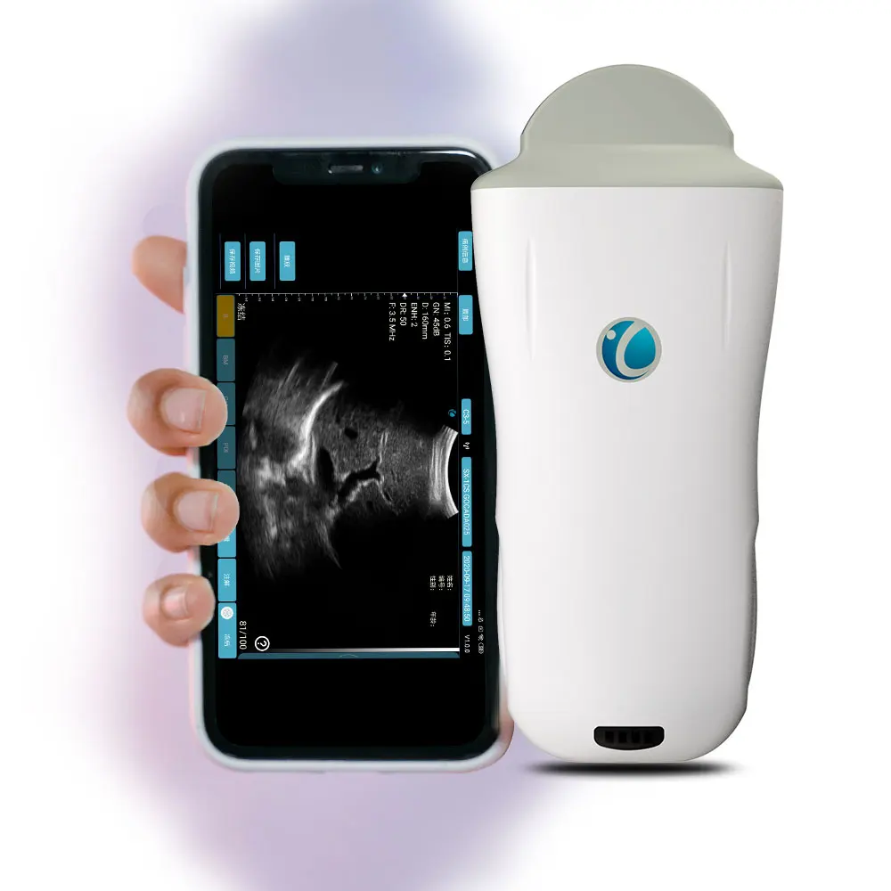 2D ecografo  de color doppler ultrasonido precio wifi ultrasound probe ultrasonic transducer probe