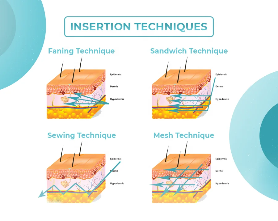 Premium Mono Collagen Thread Face Lifting Korean Hilos Tensores Para Cara Y Cuello