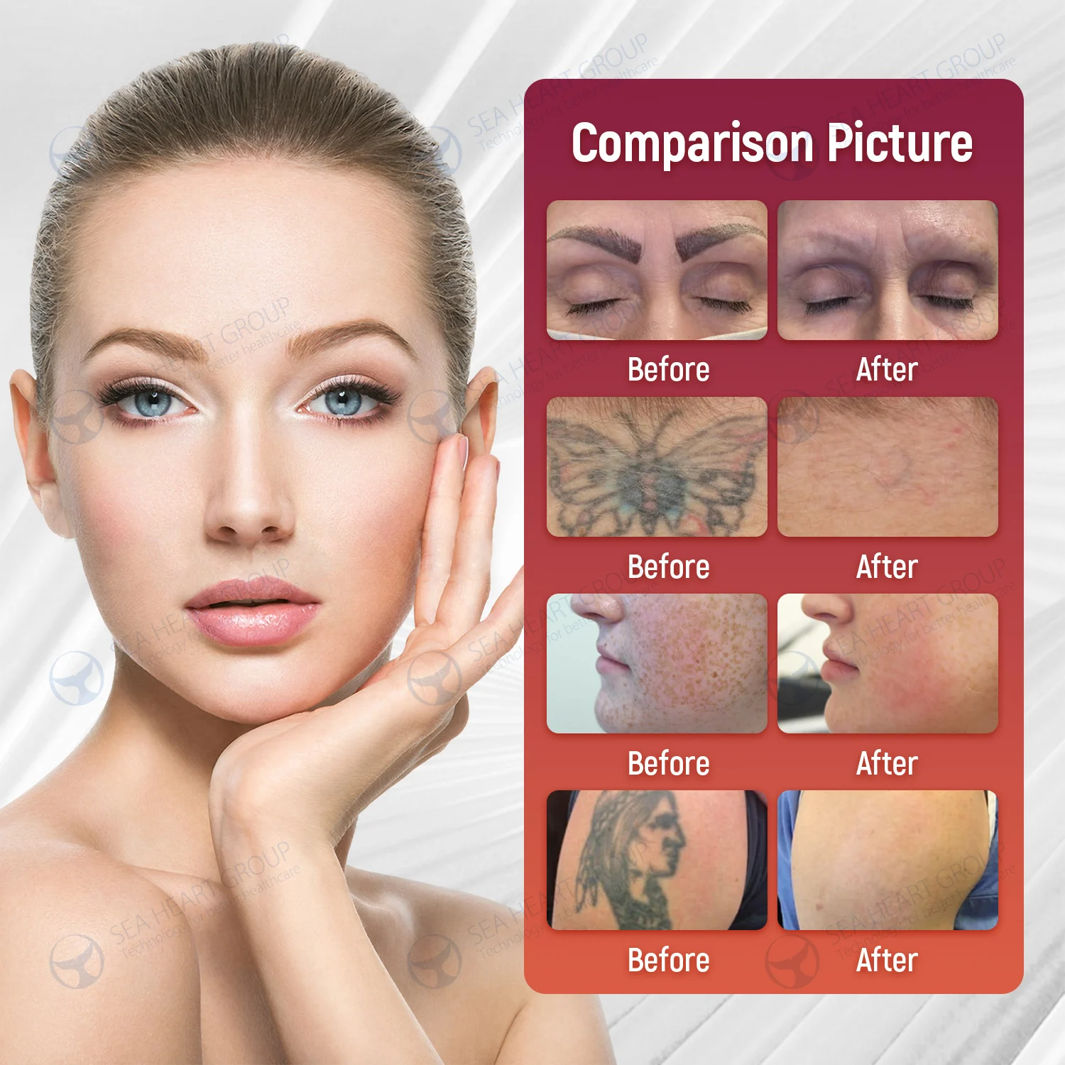 Seaheart pico 4 1064nm 532nm eyebrow tatoo remover picosecond laser tattoo removal Carbon Peel nd yag q switch laser machine