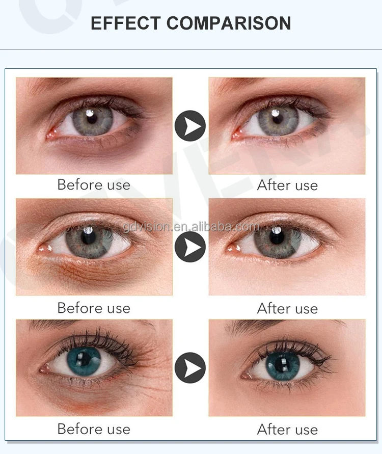 The Best Instant Anti Wrinkle OEM Dark Circles Eye Cream