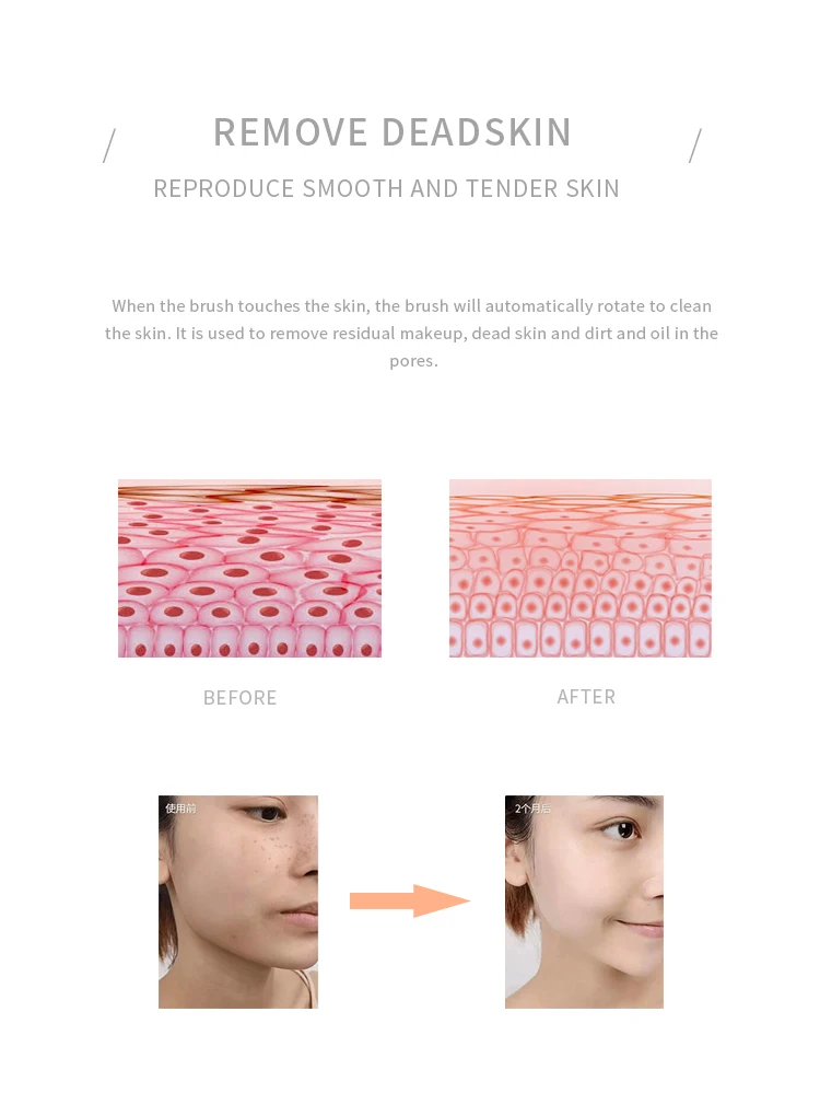 facial skin tightening