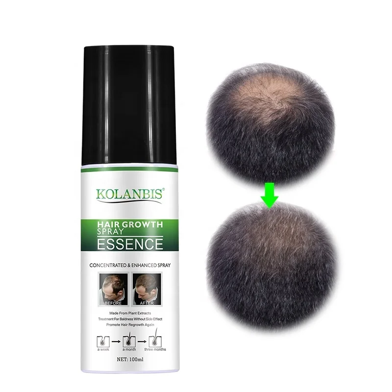 Private Label Hair Growth Essential Oil For Men Women Use