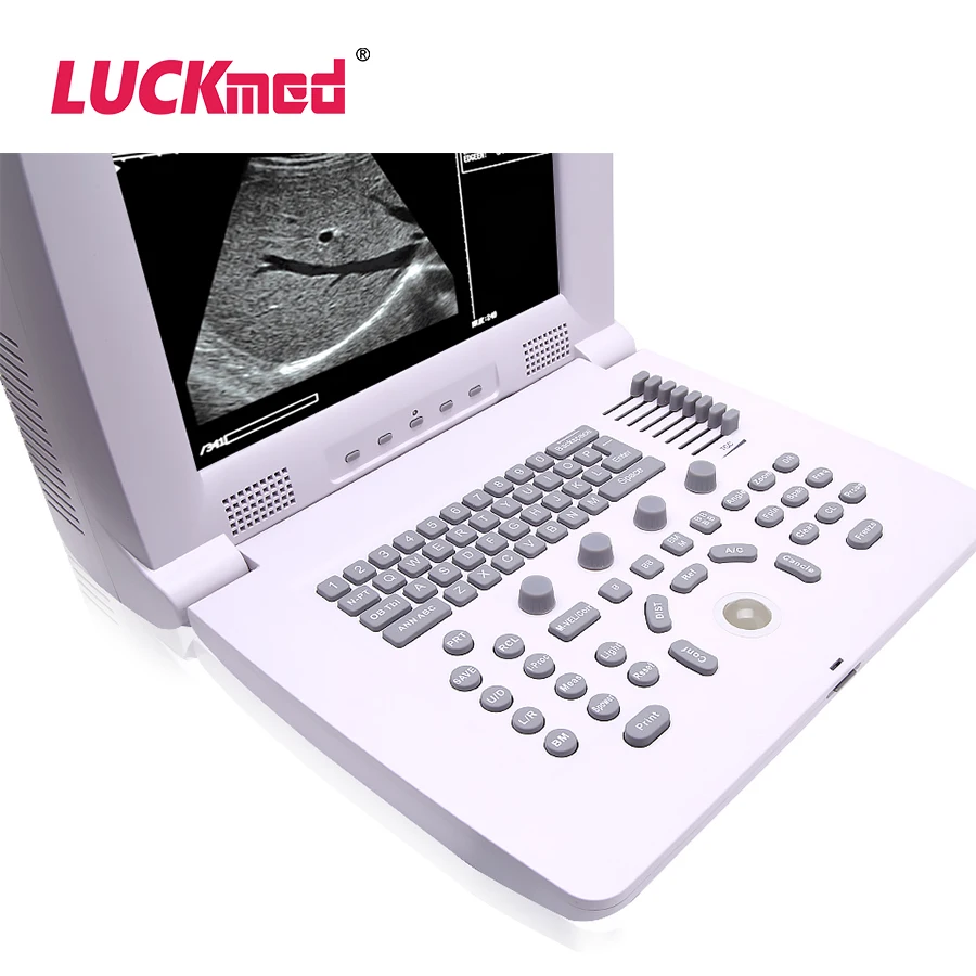 Black/white Full Digital Portable Trolley  Ultrasound Scanner Doppler Laptop echographe usg portatil machine Diagnostic System