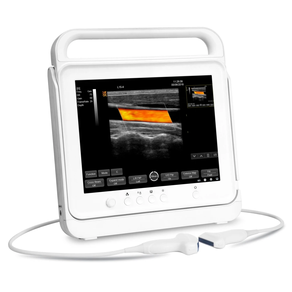 
15 Inch Digital Cheap Notebook Portable Doppler Ultrasound Machine 