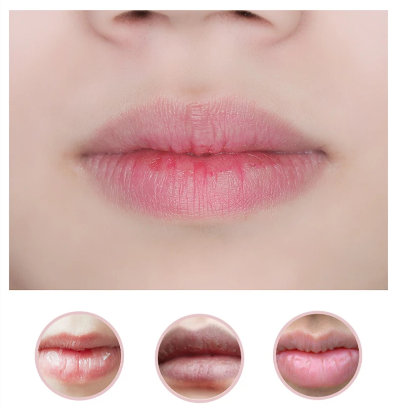 Private label gloss pink lip whitening brightening lightening bleaching cream for dark lips