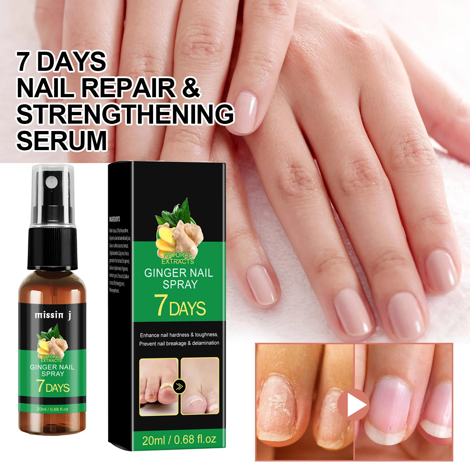 7days Nail Fungus Treatment Liquid Ginger Extract Paronychia Nail Essence Treatment Multi-Purpose Repair For Damaged Nails