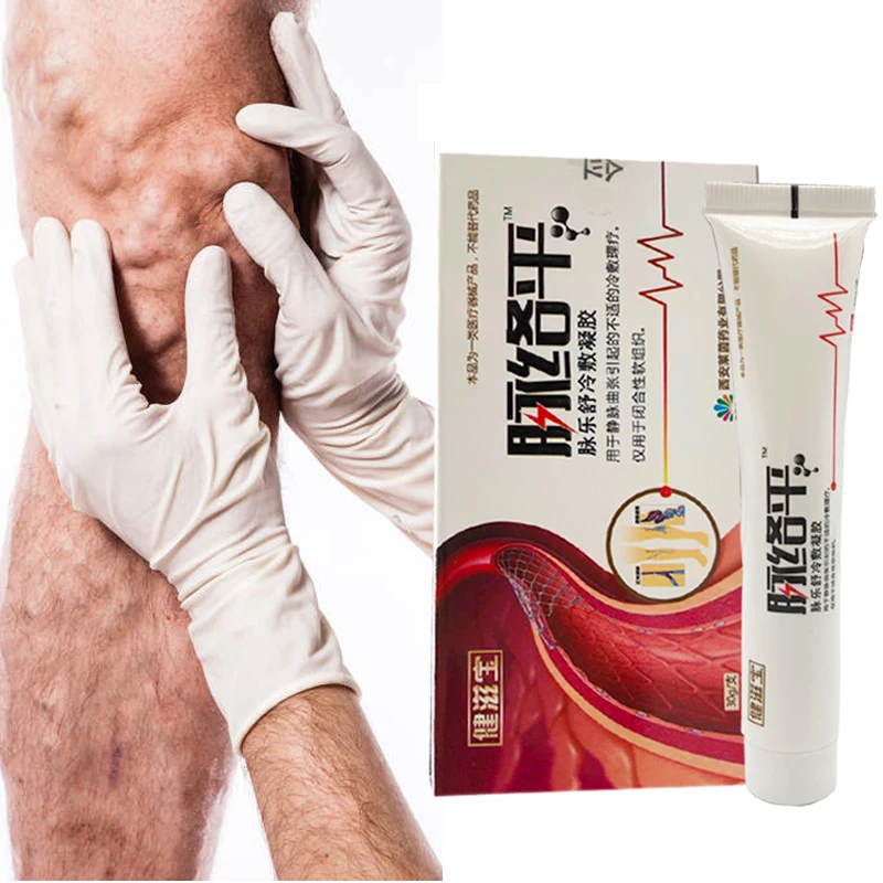 Effective Varicose Vein Relief Cream Ointment For Varicose Veins To Relieve Vasculitis Phlebitis Spider Veins Pain