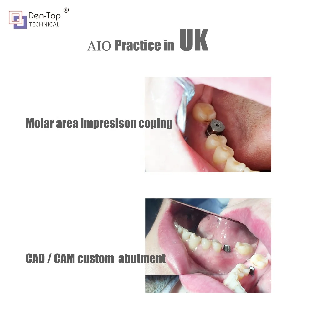 conical connection compatible  titanium implant abutment for healing gingival height 1 - 5 mm